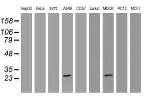 Monoclonal Mouse anti-Human BCL10 / BCL-10 Antibody (clone OTI6A8, IHC, WB)