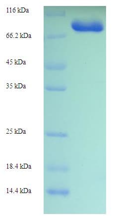 Human GK2 / Glycerol Kinase 2 Protein (Recombinant His-SUMO)