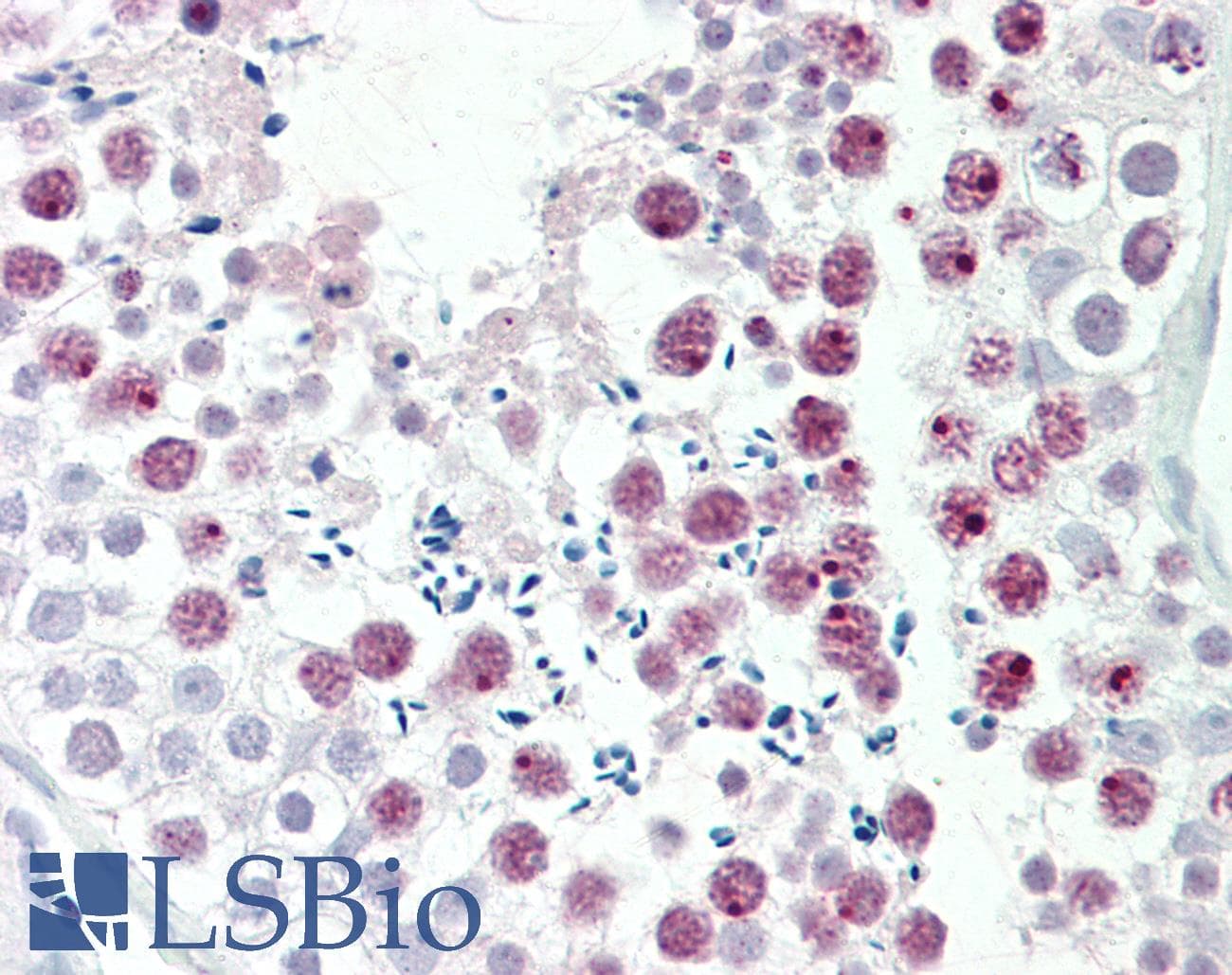 Polyclonal Rabbit anti-Human MDC1 Antibody (aa1851-1900, IHC, WB)