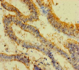 FAU / Fub1 Antibody
