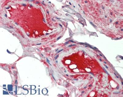 CFB / Complement Factor B Antibody (aa35-160)
