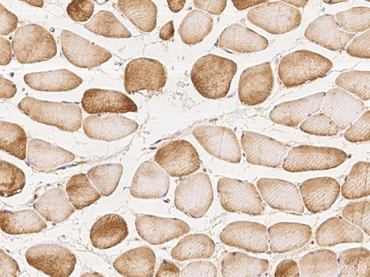 Polyclonal Rabbit anti-Human SH2B3 / LNK Antibody (IHC, IF)
