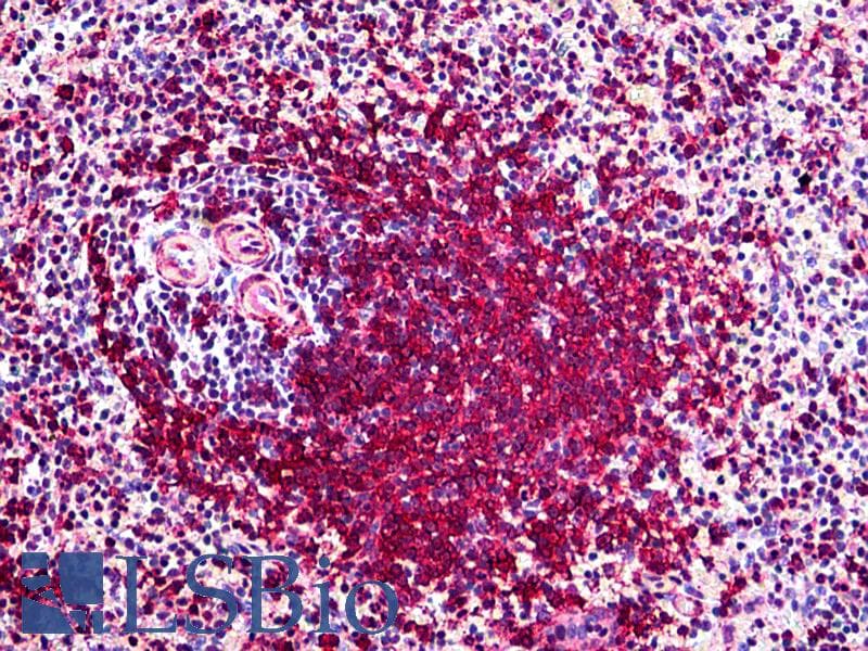 IHC-plus™ Monoclonal Mouse anti-Human POLK / DNA Polymerase Kappa Antibody (clone 6F2, IHC, IF, WB)