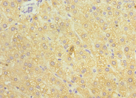 Polyclonal Rabbit anti-Human WC1 / ATP7B Antibody (aa1166-1465, IHC)
