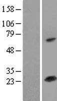 SOD2 / Mn SOD Protein (Over-Expression Lysate Myc-DDK (Flag))
