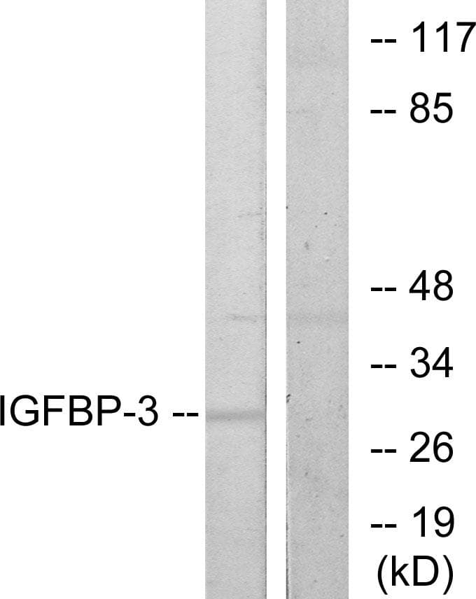 Polyclonal Rabbit anti-Human IGFBP3 Antibody (p183, IHC, WB)