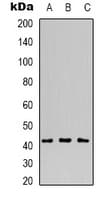 Polyclonal Rabbit anti-Human MVK Antibody (Internal, IHC, IF, WB)