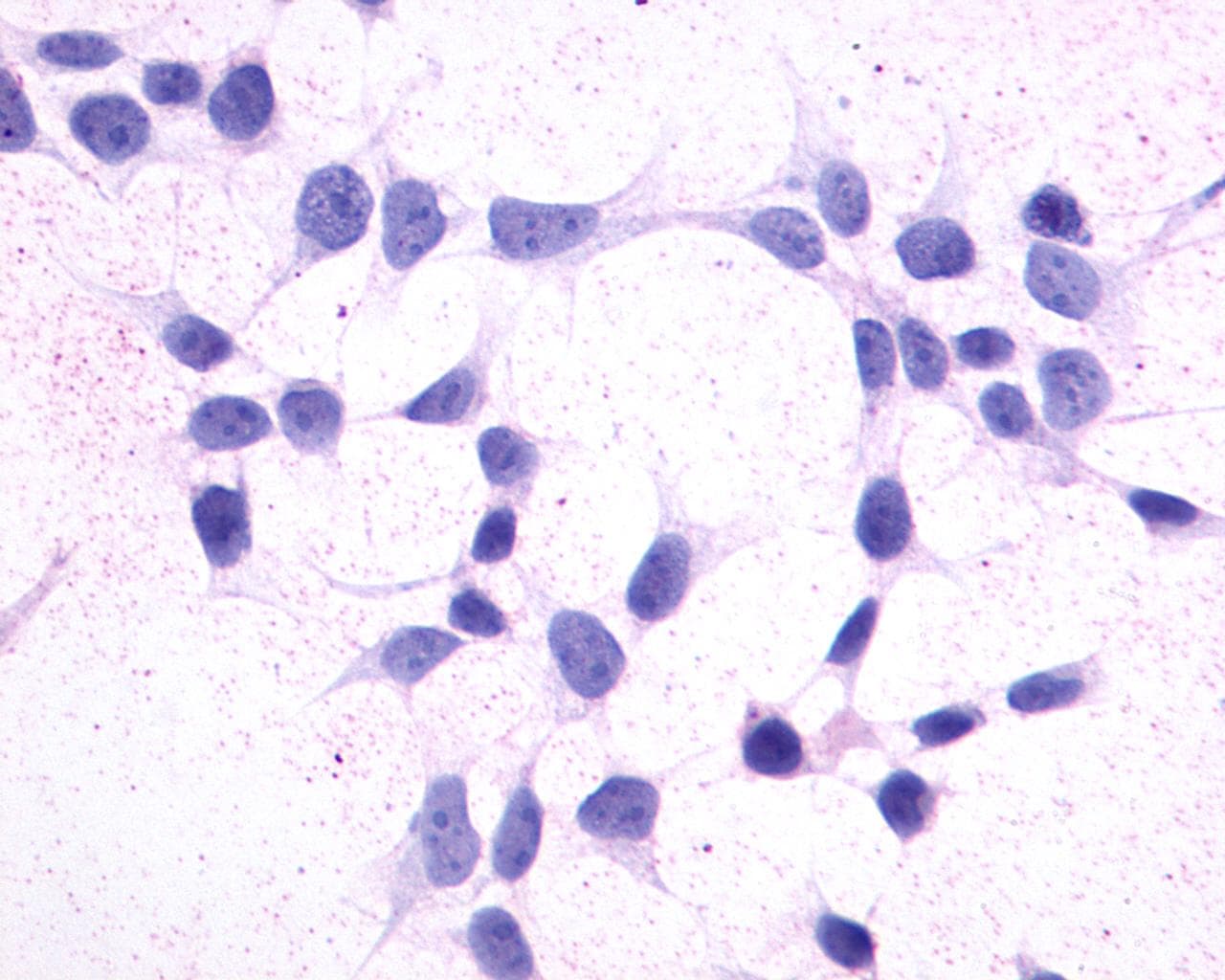 PathPlus™ GPR44 / CRTH2 Antibody (Extracellular Domain)