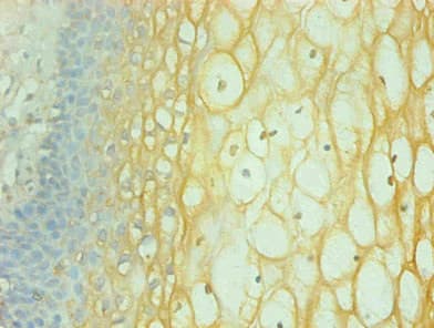 IFN Gamma / Interferon Gamma Antibody
