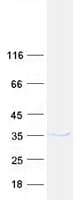 Human CUEDC2 Protein (Recombinant Myc-DDK (Flag))