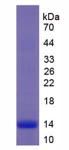 Rhesus monkey IL8 / Interleukin 8 Protein (Recombinant His)