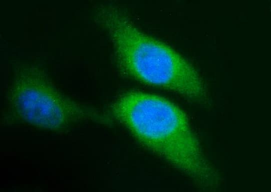 SPHK / SPHK1 Antibody (clone OTI1A6, Carrier-free)