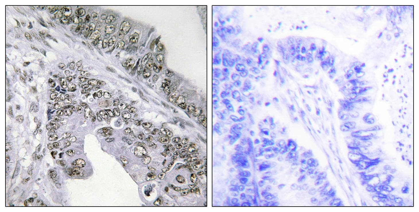 Polyclonal Rabbit anti-Human STAT1 Antibody (phospho-Ser727, IHC, WB)