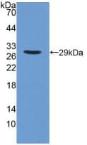 PLA2G6 / IPLA2 Antibody (aa484-701)
