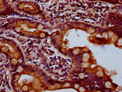 Polyclonal Rabbit anti-Human HIPK2 Antibody (IHC)