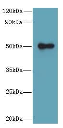 IHC-plus™ GSDMB / Gasdermin-Like Antibody