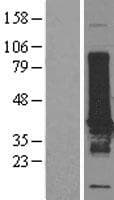EFHD1 Protein (Over-Expression Lysate Myc-DDK (Flag))
