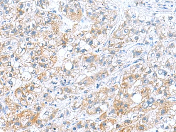 DNAL1 Antibody