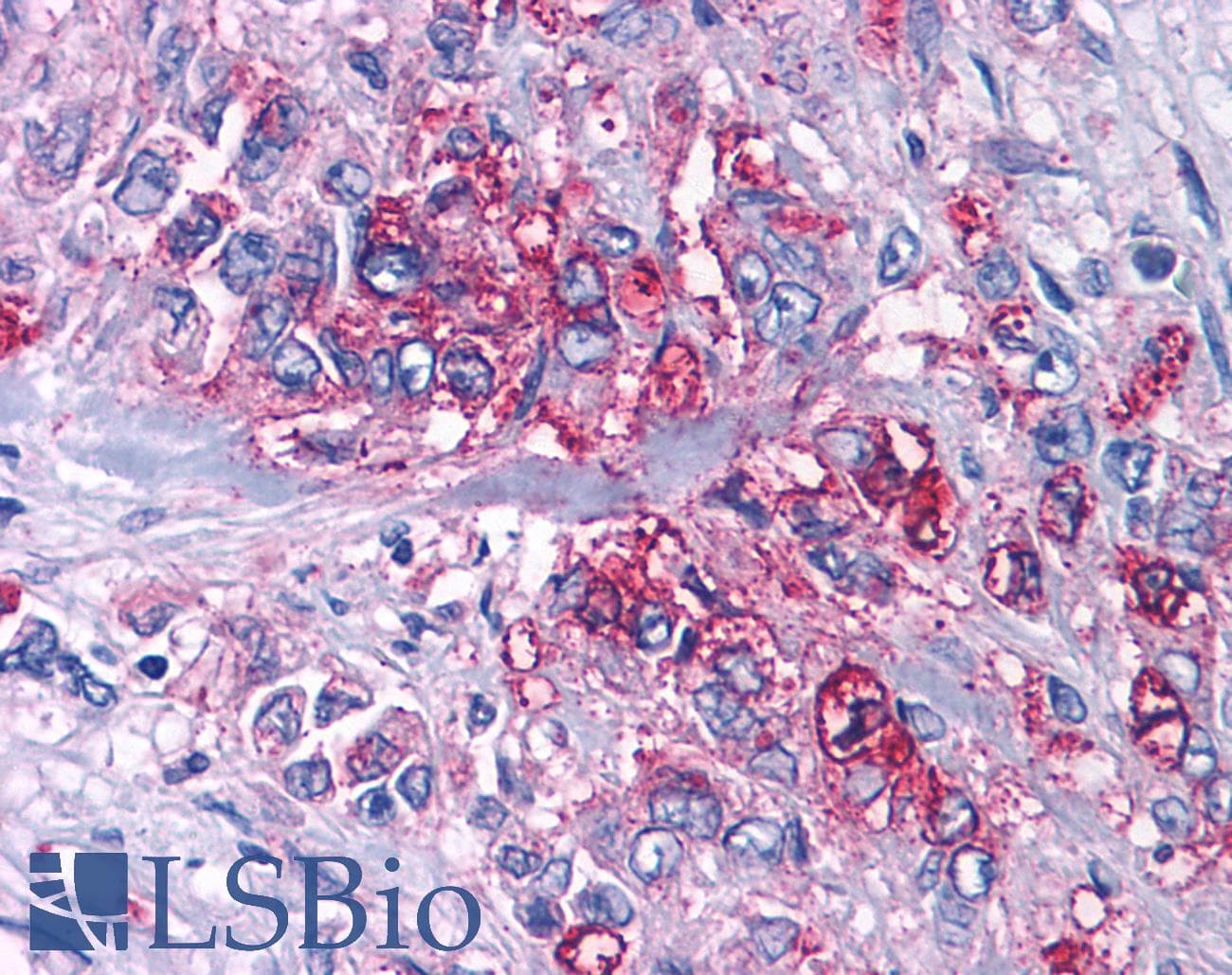 IHC-plus™ Polyclonal Rabbit anti-Human P2RY4 / P2Y4 Antibody (Cytoplasmic Domain, IHC)