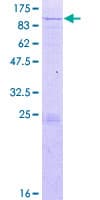 Human KLHL20 Protein (Recombinant GST)