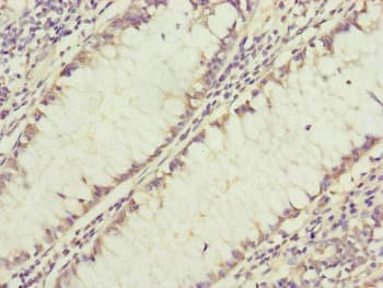 GRPEL1 Antibody