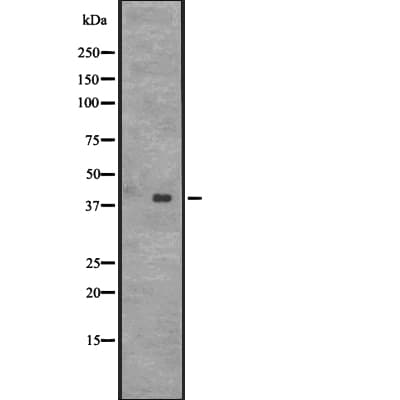 Polyclonal Rabbit anti-Human CENPL Antibody (IHC, WB)