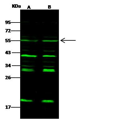 CHEK1 / CHK1 Antibody (Preservative Free)
