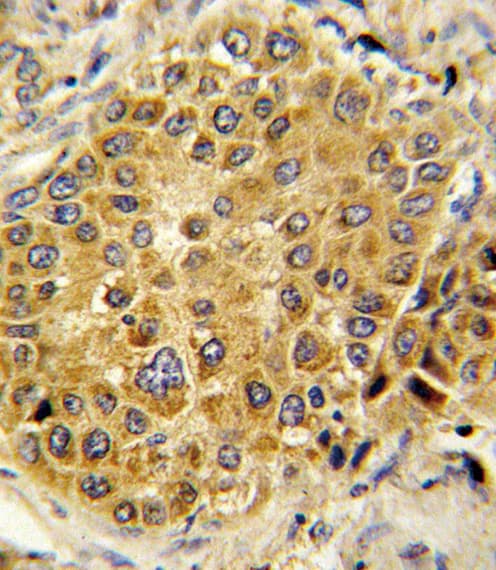 PLG / Plasmin / Plasminogen Antibody (aa636-665)