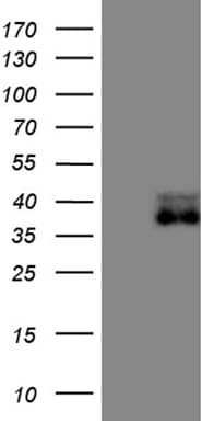 EPCAM Antibody (aa24-265, clone OTI8A9)