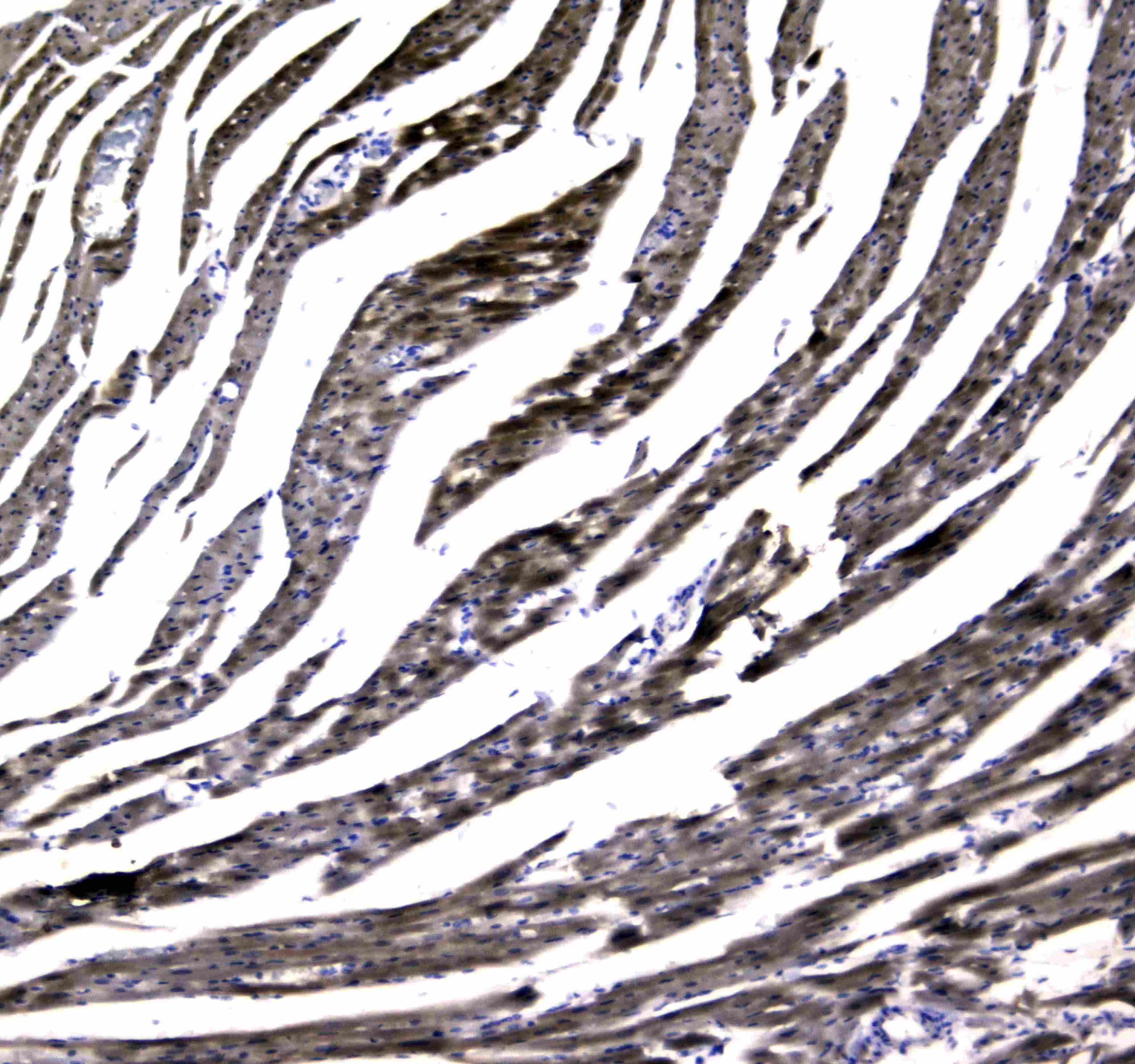 MYBPC3 / MYBP-C Antibody (aa1070-1123)