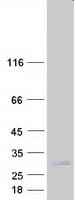 Human COPS8 / COP9 Protein (Recombinant Myc-DDK (Flag))