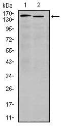 ITGA4 / VLA-4 / CD49d Antibody (clone 5C4)