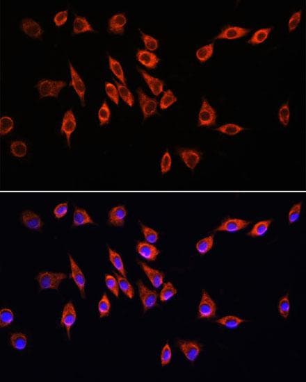 NRP1 / Neuropilin 1 Antibody