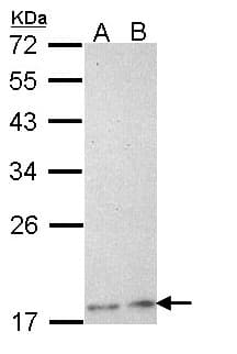 Polyclonal Rabbit anti-Human PLA2G12A Antibody (aa22-115, WB)
