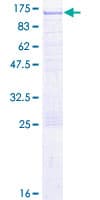 Human EPS8 Protein (Recombinant GST)