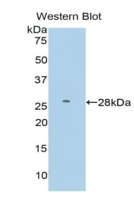 FDFT1 / Squalene Synthase Antibody (aa187-416)