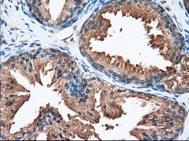 Monoclonal Mouse anti-Human PANK2 Antibody (clone OTI3H9, IHC, IF, WB)