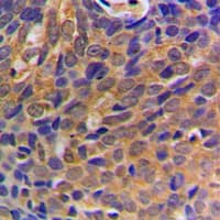 CTNNB1 / Beta Catenin Antibody (N-Terminus)