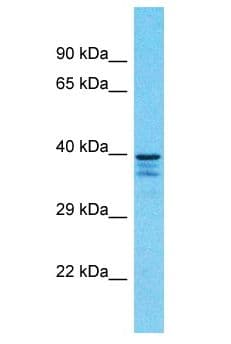 SH3GLB1 / Bif / Endophilin B1 Antibody (aa311-360)