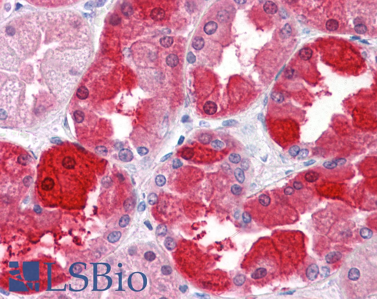 IHC-plus™ CRYM Antibody (clone 6B3)