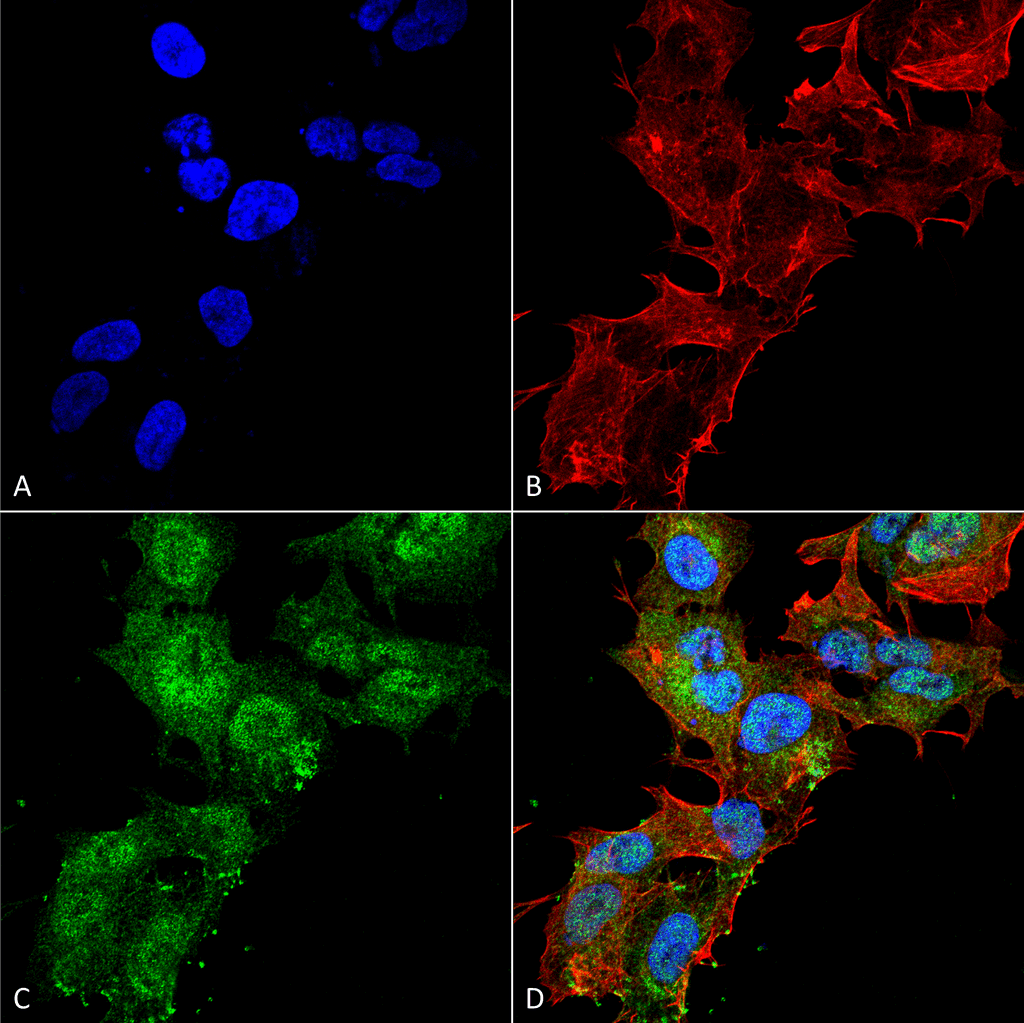 CASR/Calcium Sensing Receptor Antibody (PerCP)
