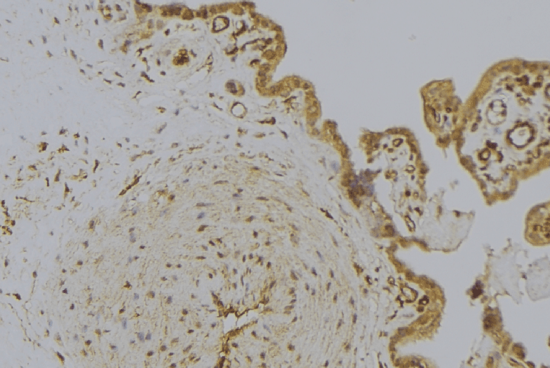 HSPB11 Antibody