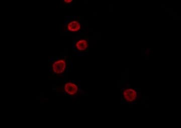 GSCL / GSC2 Antibody