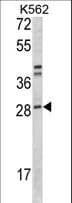 MIBP / ITGB1BP3 Antibody (aa27-55)