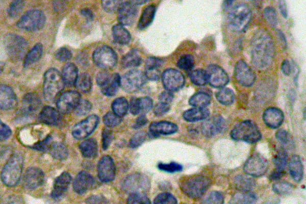 Polyclonal Rabbit anti-Human MAP3K5 / ASK1 Antibody (phospho-Ser966, IHC, WB)