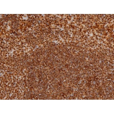 Polyclonal Rabbit anti-Human EZR / Ezrin Antibody (phospho-Tyr353, IF, WB)