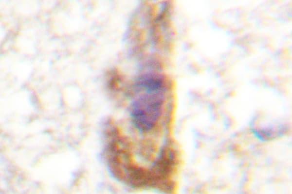 PRKCZ / PKC-Zeta Antibody (Pro556)