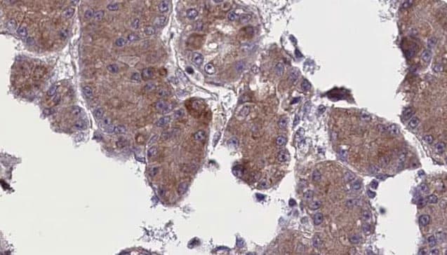OR52N5 Antibody