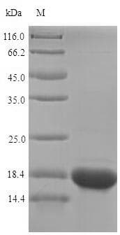 Human SELM / Selenoprotein M (Recombinant 6His, N-terminus)