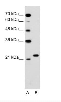 RAB14 Antibody (C-Terminus)